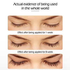 CilsVita Boost -Eyelash Growth in 7 Days