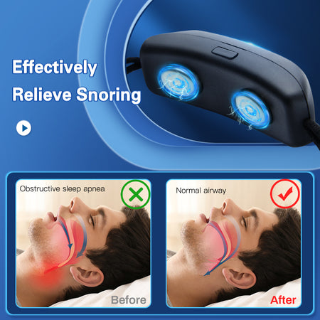 SilentNite Smart Anti-Snoring
