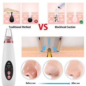 SKINFIX Pore and Blackhead Cleaner