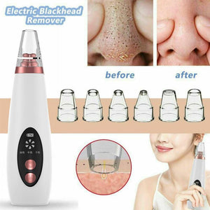 SKINFIX Pore and Blackhead Cleaner